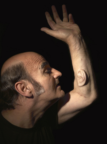 Stelarc, Extra Ear: Ear on Arm